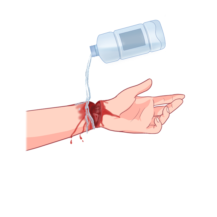 응급처치방법1
