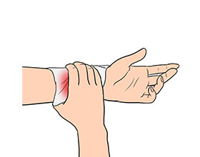 응급처치2