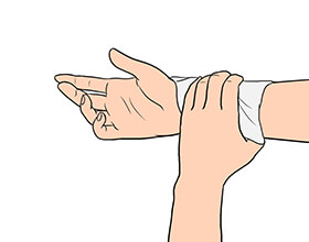 응급처치4
