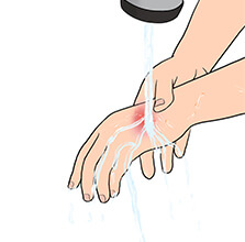 응급처치2