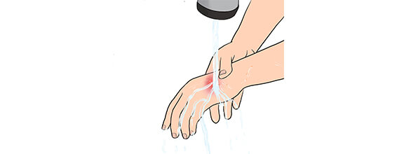 개 등에 물렸을 때 응급처치1